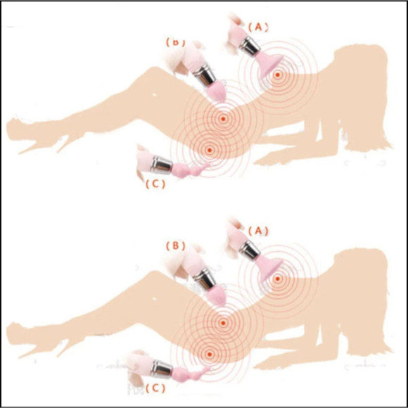 Белый вибратор-брелок с 3 сменными насадками Белый вибратор-брелок с 3 сменными насадками